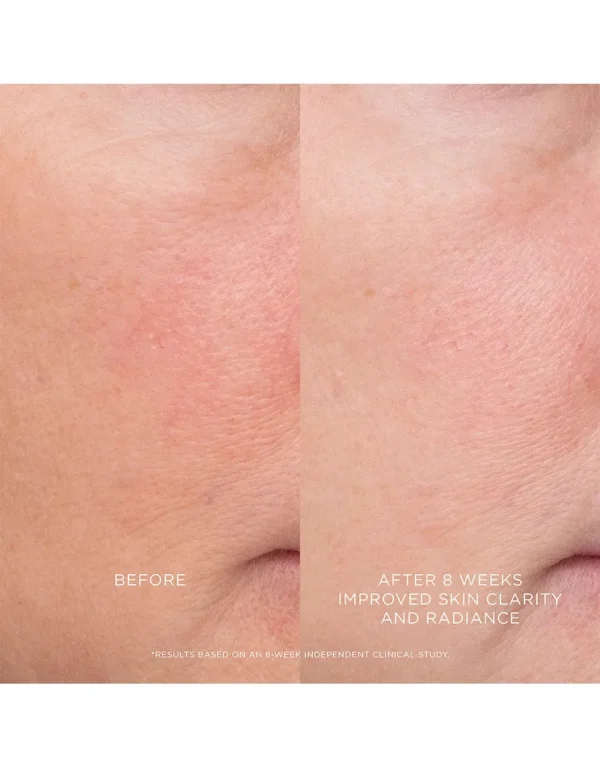 Equilibrium Resurfacing Retinoid Treatment - Image 4