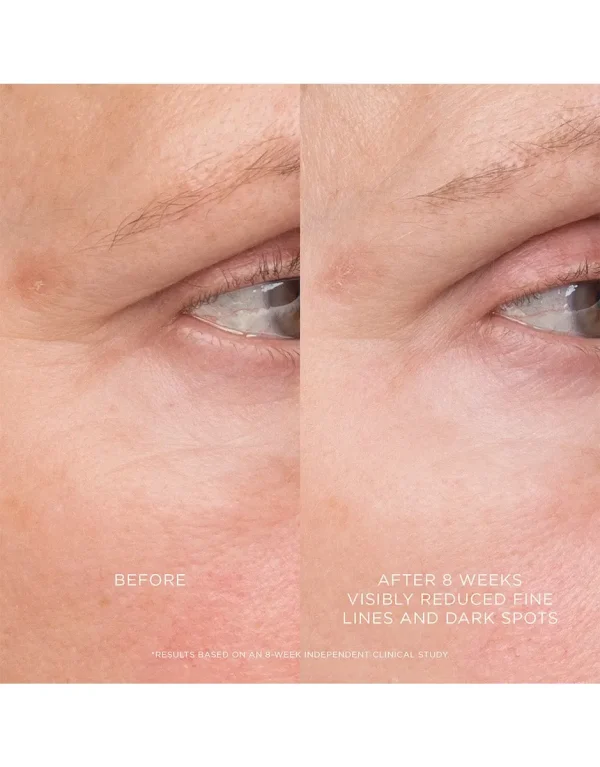 Equilibrium Resurfacing Retinoid Treatment - Image 3